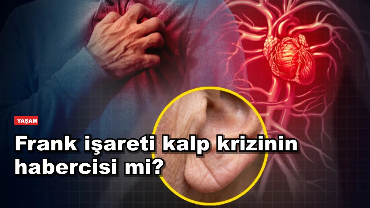 Frank işareti kalp krizinin habercisi mi? Uzman açıkladı