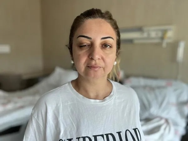 Mersin Tarsus sahte botoks sonrası hastanede tedavi gören kadın
